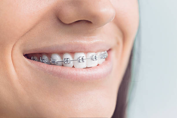 Sleep Apnea Treatment in North Charleston, SC